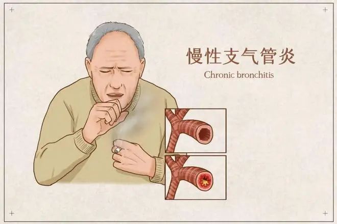 冬季常见疾病！12月这些事要提醒！